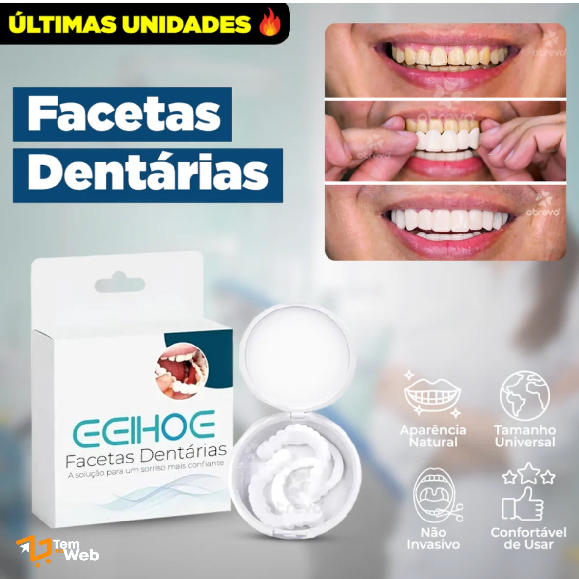 Facetas Dentárias Naturais Removíveis (SUPERIOR E INFERIOR) - Modelo Ajustável - Adulto