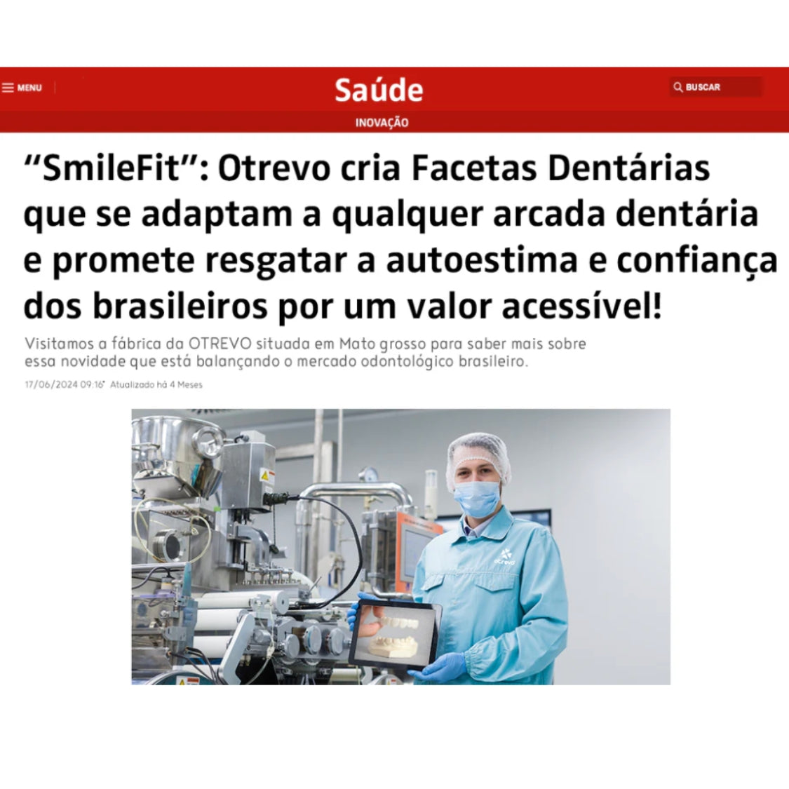 Facetas Dentárias Naturais Removíveis (SUPERIOR E INFERIOR) - Modelo Ajustável - Adulto